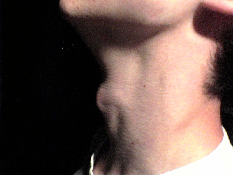 800px-Myneck